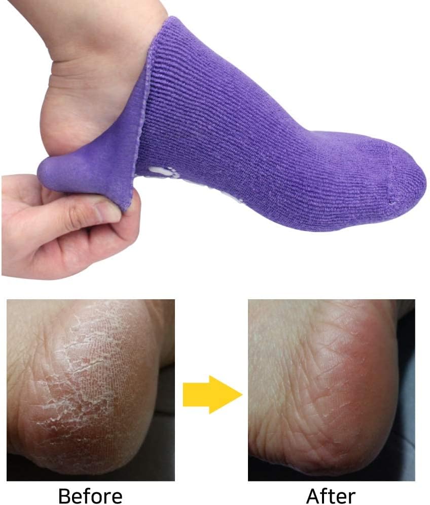 Moisturizing socks